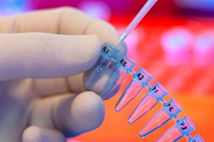 Welche Tests werden für Parasiten durchgeführt