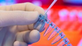 So machen Sie Tests für Parasiten
