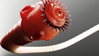 Arten von Parasiten im menschlichen Körper