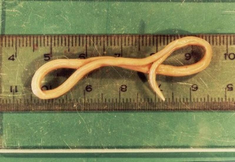 Nematodenparasiten aus dem menschlichen Körper