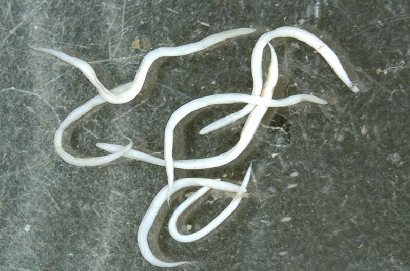 parasitärer Wurm aus dem menschlichen Körper