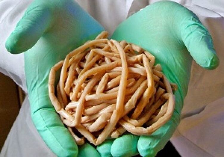 Parasitäre Würmer aus dem menschlichen Körper