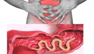 Symptome des Vorhandenseins von Parasiten im menschlichen Darm