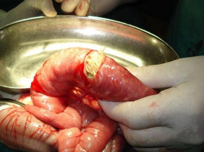 Diese Parasiten sind gefährlich für den Menschen